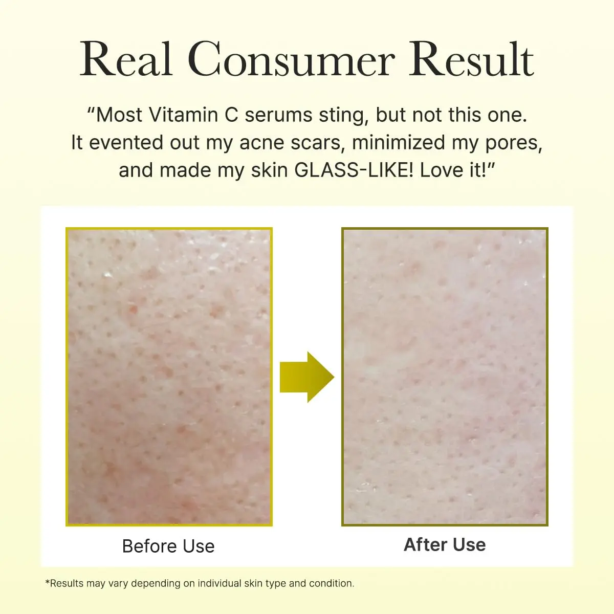 glutathione best cream Bột pha tiêm Gluthion 600mg trị nhiễm độc dạng bột đông khô main image 0