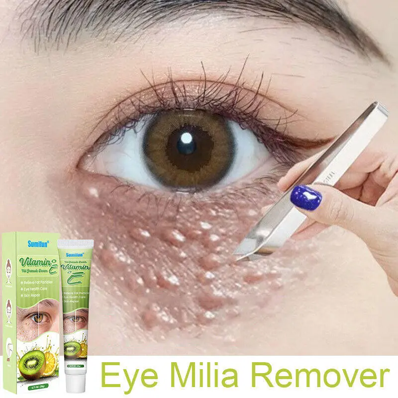 Krim Herbal Penghilang Milia dan Bintik Lemak Area Mata & Hidung dengan Vitamin E - Perawatan Wajah 20g | Formula Alami Efektif 2