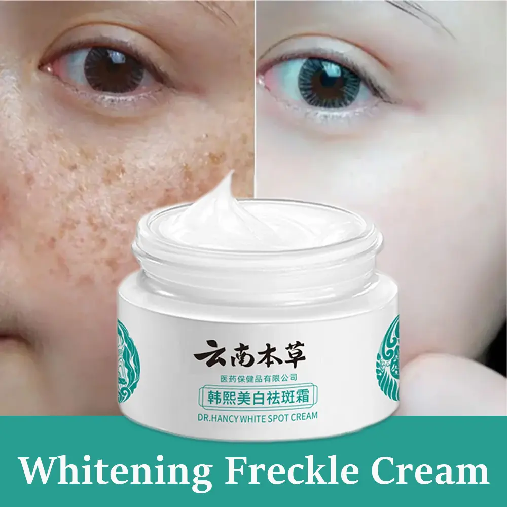 Original melasma cream Japanese freckle cream Pecas remover cream Yunnan herbal whitening moisturizing cream blemish cream