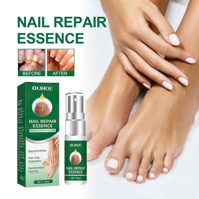 Product Introduction of 100% Original Brand Ouhoe Toenail Repair Essence Gray Nail Soft Yellow Thickening Inlay Bright Manicure Comfort 0
