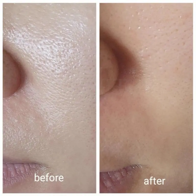 [VT Cosmetic] Tinh Chất vi kim Reedle Shot 100/300/700 50ML 30ML dưỡng da Skincare Làm Đẹp Da 8