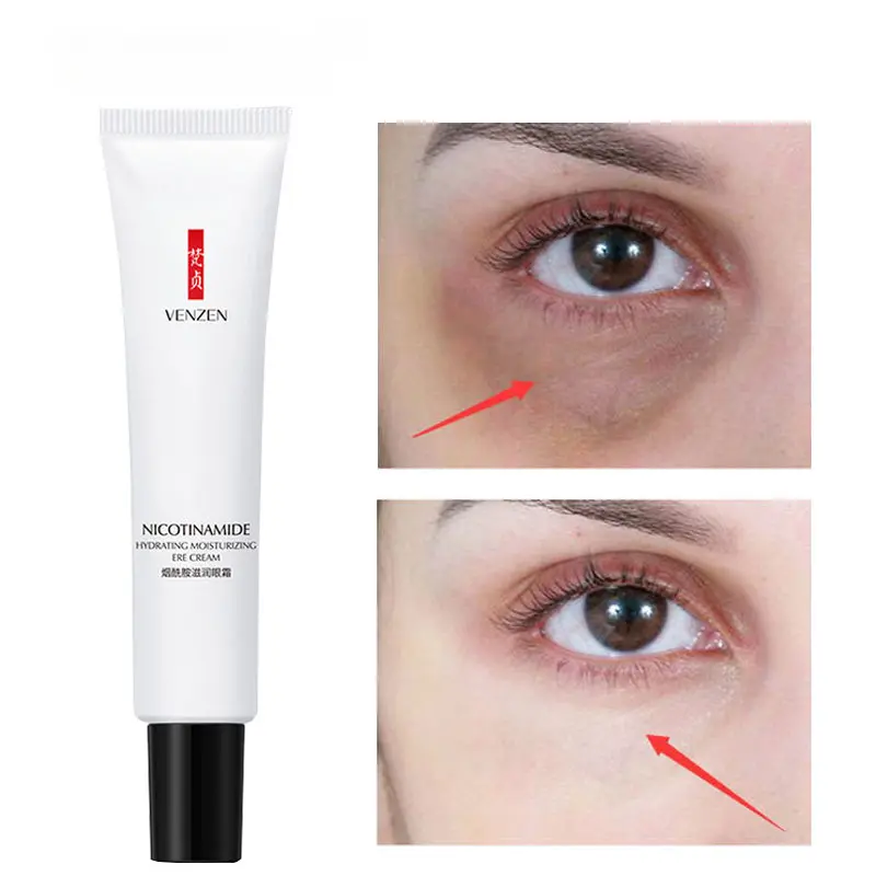 Nicotinamide Eyes Cream Whitening Dark Circles Remove Eye Bags Under Eye Hyaluronic Acid Moisturizing Serum Against Puffiness