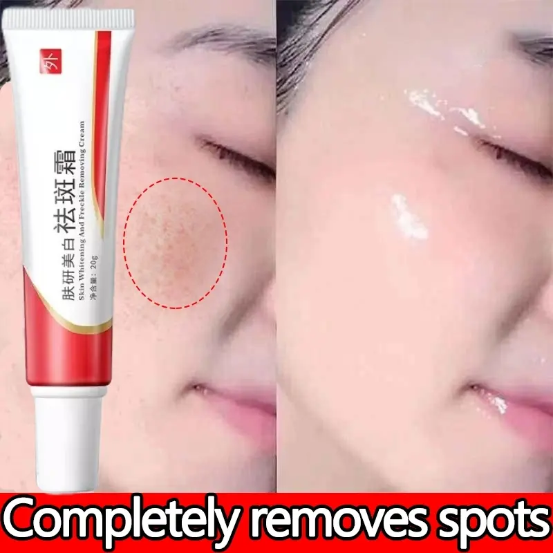 Kem Trị Nám, Nhật Bản, Thảo Dược, Làm Trắng, Kem Trị Tàn Nhang, Chính Hãng, Kem Dưỡng Ẩm Cao, Kem Trị Mụn, Chống Nắng, Loại Bỏ Tàn Nhang Và Vết Thâm Trên Da, Thích Hợp Cho Chloasma Và Vết Thâm Trên Da