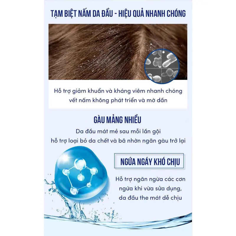 Dầu gội chống gàu Mochi Medical Nhật Bản dầu gội sạch gàu Mochi hết nấm ngứa trong 2 tuần 7
