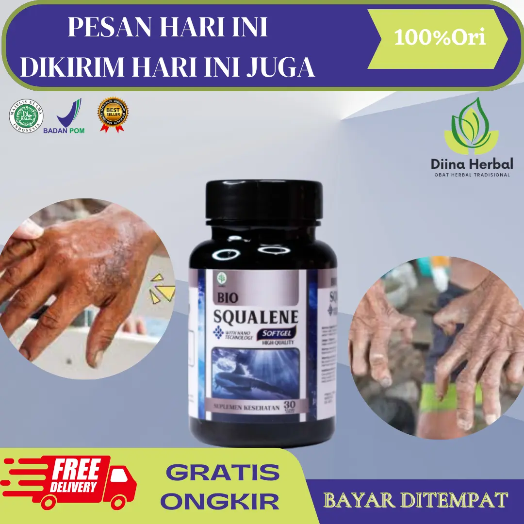 Penyakit Kusta Kering, Herbal Untuk Penyakit Kusta, Kusta Lepra, Kusta Basah, Kusta Kering Mati Rasa, Kusta DiTangan, Kulit Kaku Dan Kering, Luka Kusta, Kulit Bersisik, Kusta Menahun