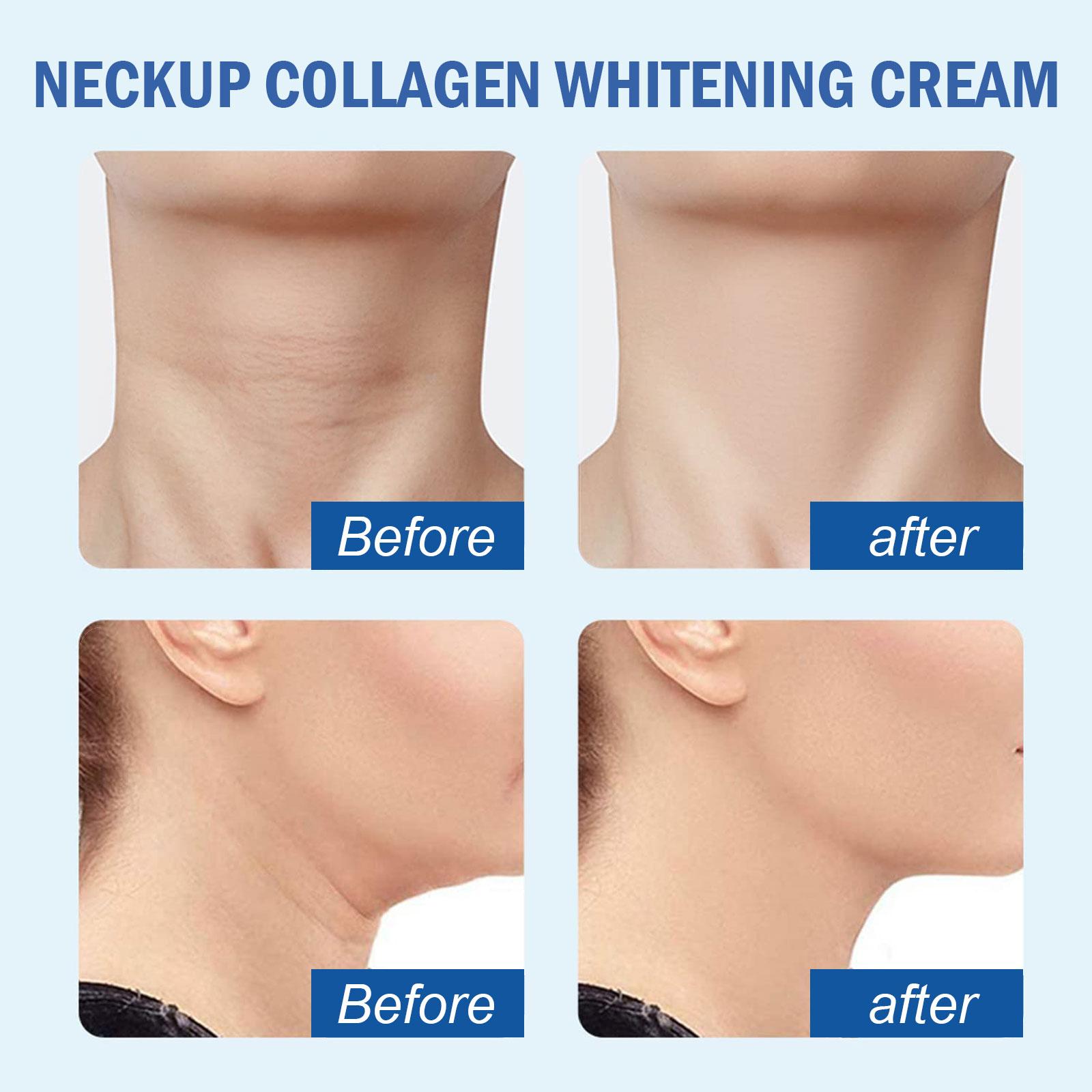 Krim Pemutih Kolagen Leher EELHOE, Menghaluskan Garis Leher, Mengangkat dan Mengencangkan Leher, Krim Perawatan Leher Angsa