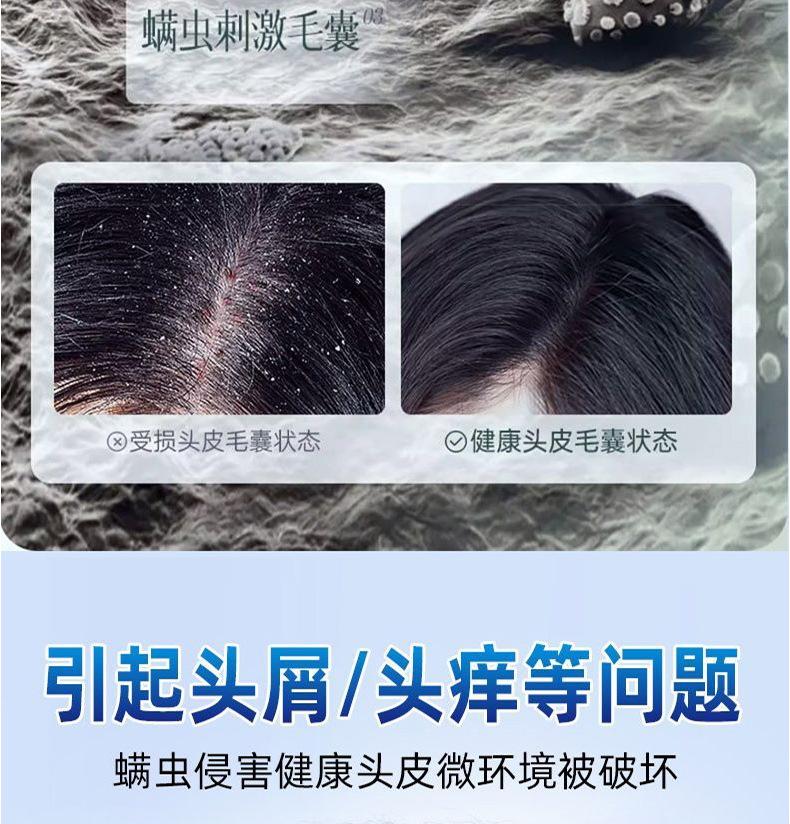 Product Introduction of Xikangwang Anti-Dandruf and Relieve Itching Washing Water Oil Removing Refreshing Skin Washing Cream Anti-Mite Grease-Overflow Moss Lotion 6