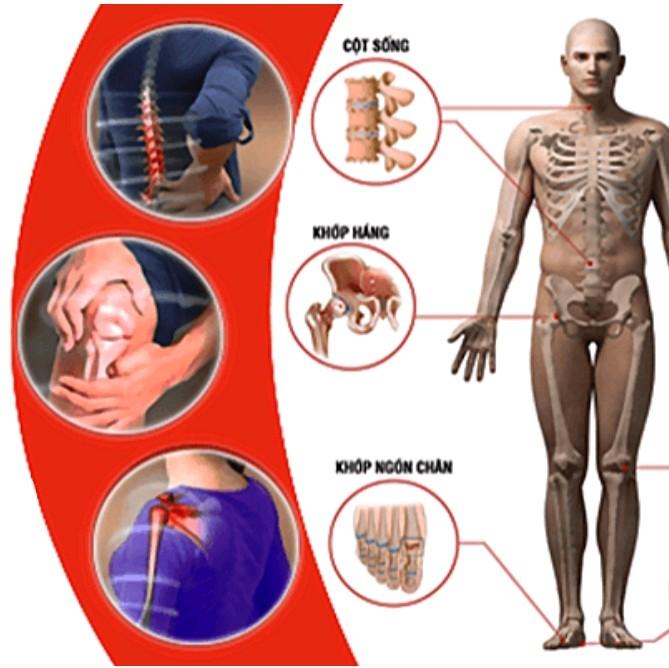 Kem bôi hỗ Trợ xương Cơ Khớp dầu gừng Tuýp 20g Tổ Chức Gel, Cho Cột Sống Lưng, Thoát Vị Đĩa Đệm,Thoái Hoá, Bong Gân, Chứa Axit Mồ Hôi! 8