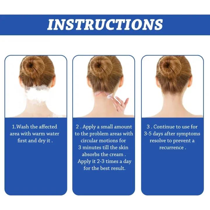 Krim Kulit Kepala Bersisik SOUTHMOON Terlaris 50g| Krim Dermatitis Seboroik| COD PROMO| Meredakan Ketombe Parah| Dermatitis Seboroik| Korengan| Infeksi Jamur| Kulit Kering dan Mengelupas