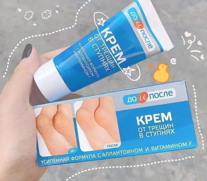 Kem Hỗ Trợ Giảm Nứt Gót Chân Nữ Kpem Nga Chính Hãng 50ml Cosmetic Women 4