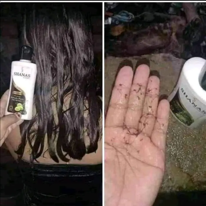 Shanas Nasa Shampo Pembasmi Kutu Rambut / Kutu Rambut dan Telurnya  / Shampo Kutu Rambut / Sampo Anti Kutu /  Pembersih kutu Shampo