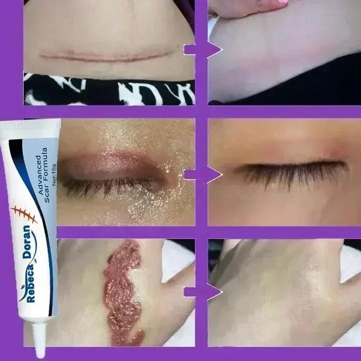 Product Introduction of Maternity Cream That Enhances Elasticity, Gentle Skin Care After Pregnancy, Eliminates Stretch Marks, and Is Very Effective body  moisturizers 12