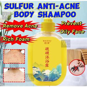 Sabun Gel Mandian Sulfur Pencuci Pengilang Huma Antibakteria Pembersihan Dalam Penyingkiran Kutu Melegakan Anti-Mite Rawatan Kulit Gatal Cecair Pelembap Putih Mandi Sombong Mite Removal Body Shampoo Reduce Manintain Skin Itching Whitening Smooth Rich Foam