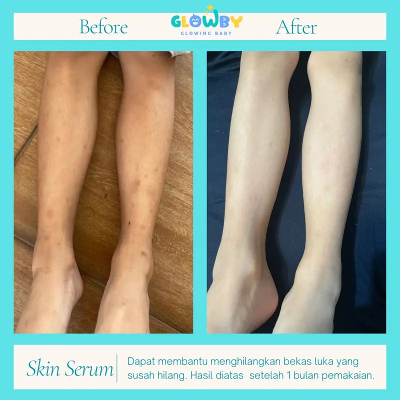 Glowby Skin Serum Lotion Pencerah Kulit Bayi dan Anak 2
