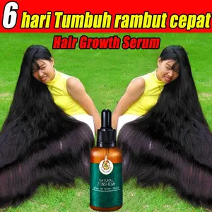 obat penumbuh rambut botak-serum penumbuh rambut botak-Obat rambut botak-Ginger King Serum Anti Botak-minyak penumbuh rambut-obat penumbuh rambut botak pria-penumbuh rambut botak wanita-Care Beauty Minyak Essensi Penumbuh Rambut Rontok-Clothes of Skin