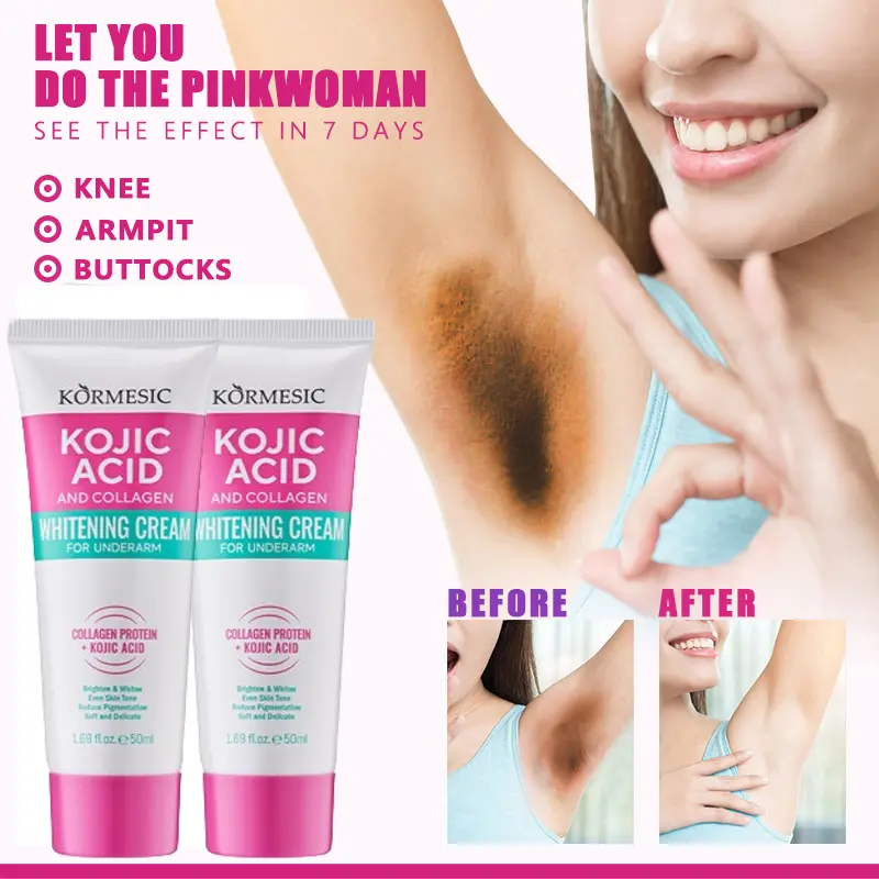 underarm whitening cream whitening underarm cream whiter armpits dark spot remover blemishes whitening cream moisturizing whitening lasting body Hand Foot Skin Cream private parts whitening healthy