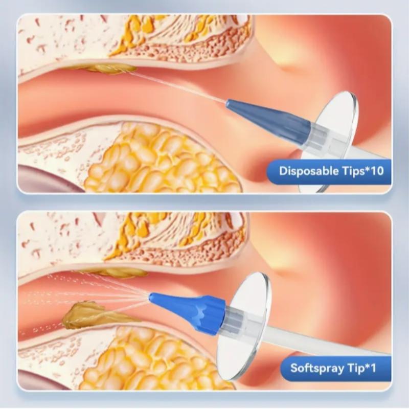 Earwax Removal Tool, 1 Box Manual Earwax Cleaning Tool, Safe & Effective Earwax Removal Tool for Adults 6