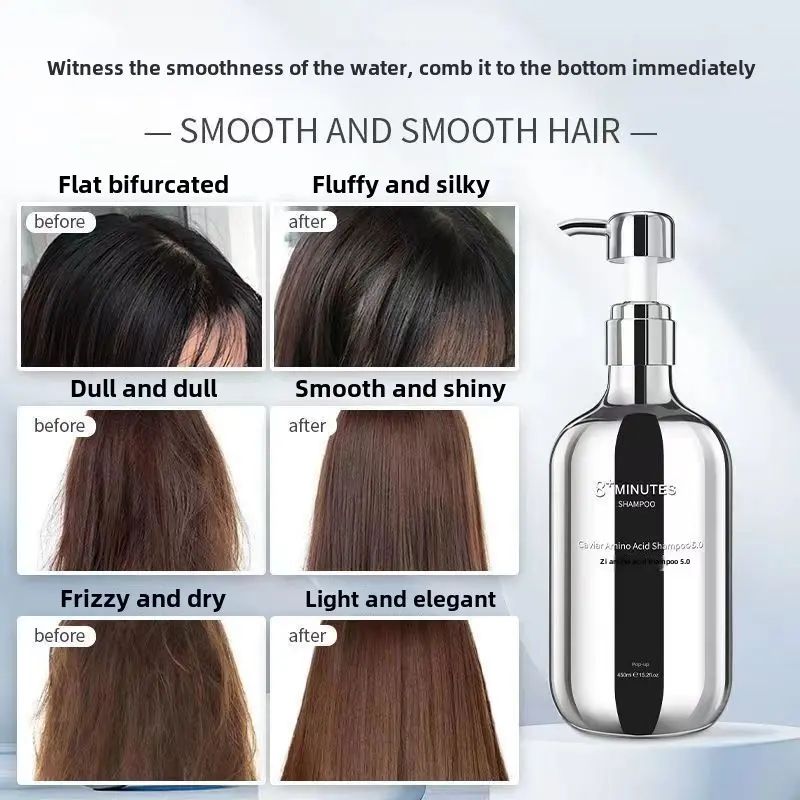 Caviar amino acid shampoo oil control fluffy anti-dandruff anti-itching shampoo