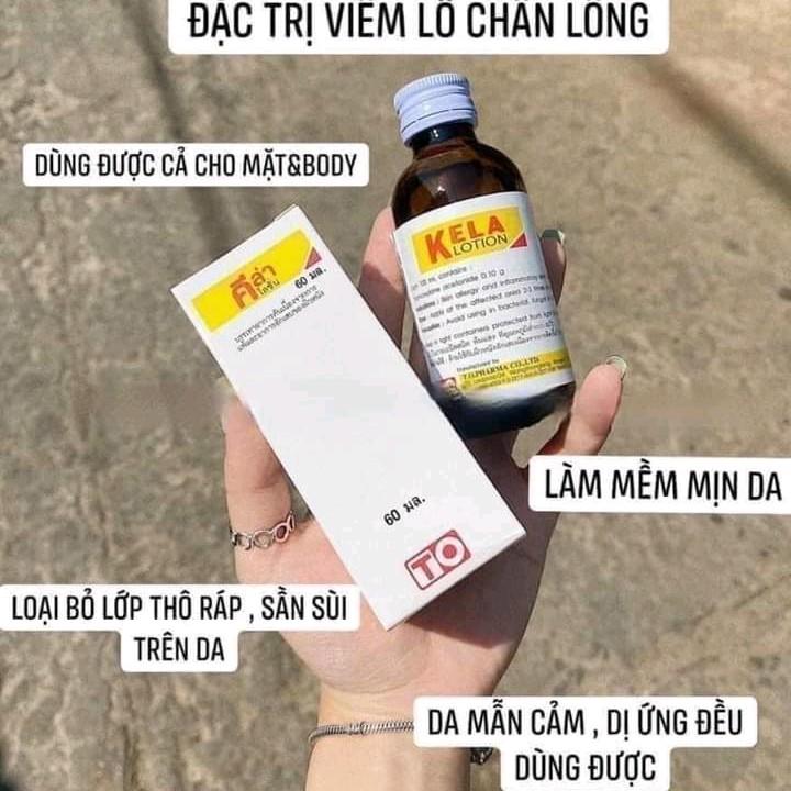 Dung dịch Kela Lotion 30ml/60ml Thái Lan 2