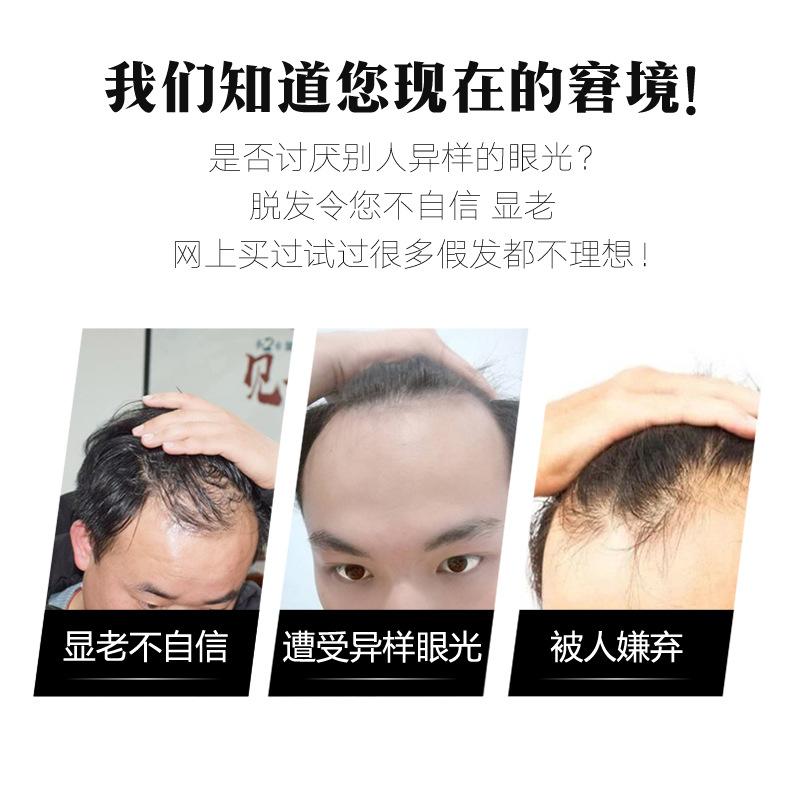 Hairline Wig Men's Wig Patch Forehead Replacement Piece Real Hair Full Hand-woven Biological Scalp Bangs 4