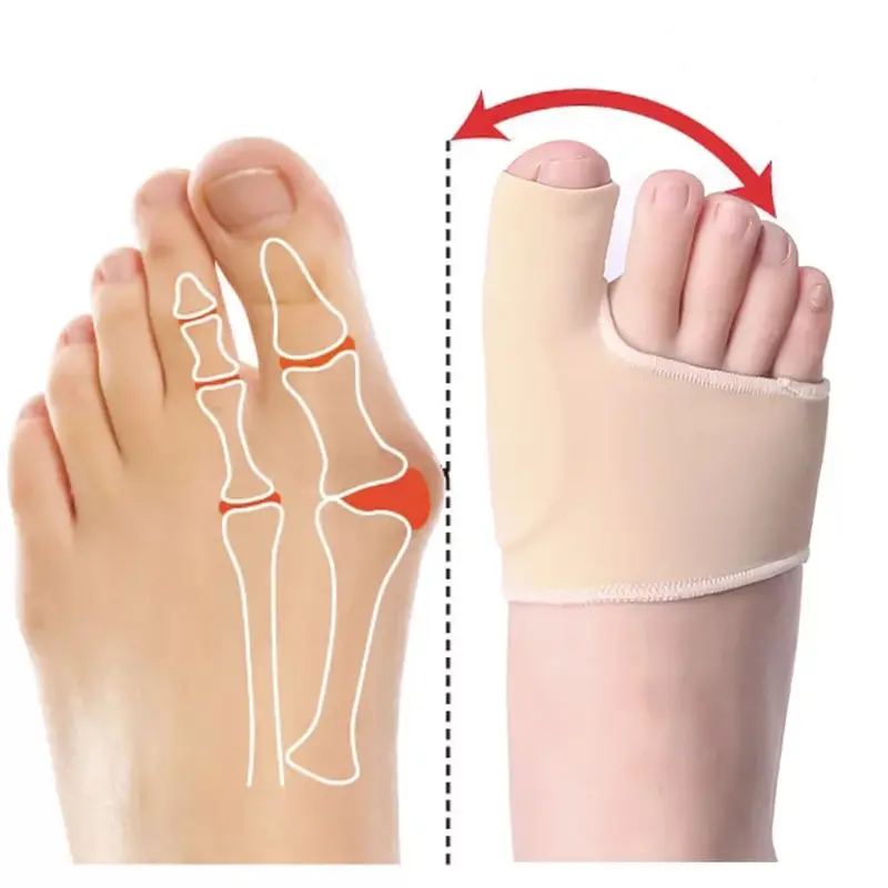 2PCS PELINDUNG JEMPOL KAKI HALLUX VALGUS BUNION CORRECTOR ORTHOTICS 5