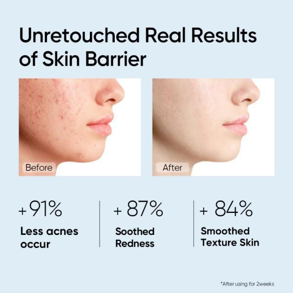 Product Introduction of SKINTIFIC 5X Ceramide Barrier Moisture Cream Ceramide Moisturizer Repair Skin Barrier Moisturiser 80g Valentine Gift Skincare Daily Restore Comfort Hydrating Hydrate 3