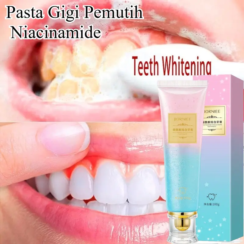 Pasta Gigi Pemutih Niacinamide Probiotik Segar Napas Perontok Karang & Pembersih Gigi Putih