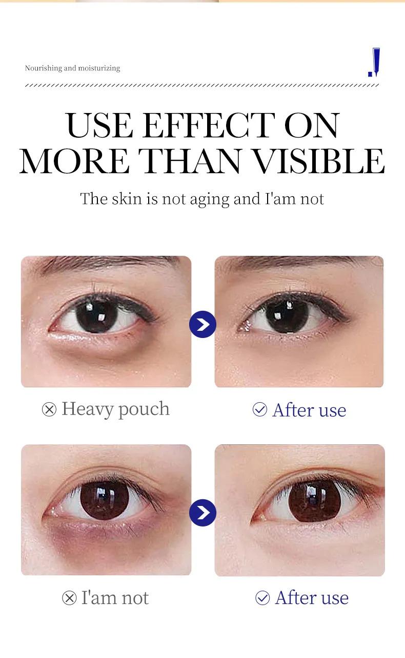 Product Introduction of Kem Mắt Collagen, SADOER, Chống Lão Hóa, Giảm Nếp Nhăn, Quầng Thâm, Bổ Sung Retinol, 20g 18
