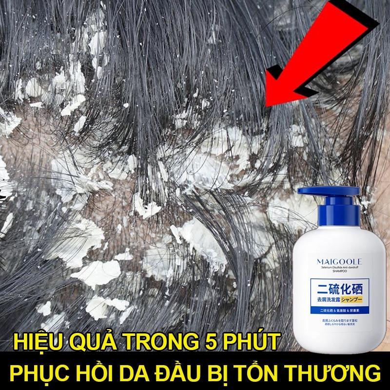 Dầu gội giảm nấm ngứa da đầu Maigoole 300ml làm sạch sâu da đầu Làm mới kiểm soát dầu loại bỏ ngứa ngáy