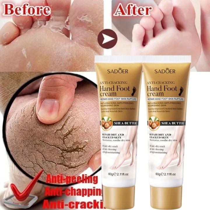 Kem trị nứt gót chân kem nứt gót chân kem bôi nứt gót chân Kem Dưỡng Ẩm Chống Nứt Nẻ Gót Chân 60gChống Nẻ Da Cho Bé Cosmetic Women