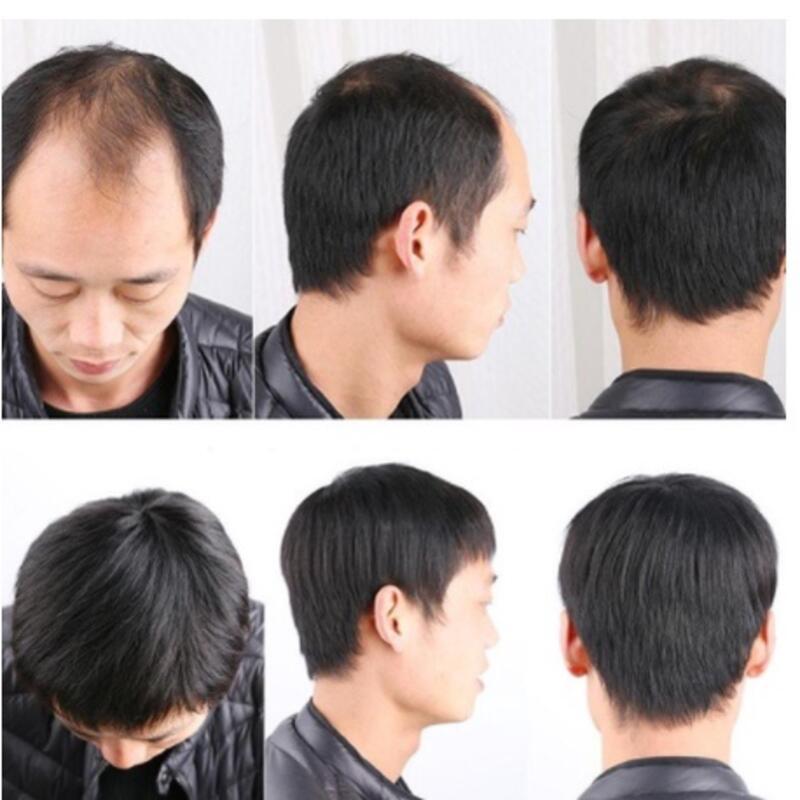 Product Introduction of High end men's wigs, real hair, fake to fake。Short Handsome Korean Style Wig Hairpiece Breathable Forehead Replacement Cover White Hair And Baldness 4