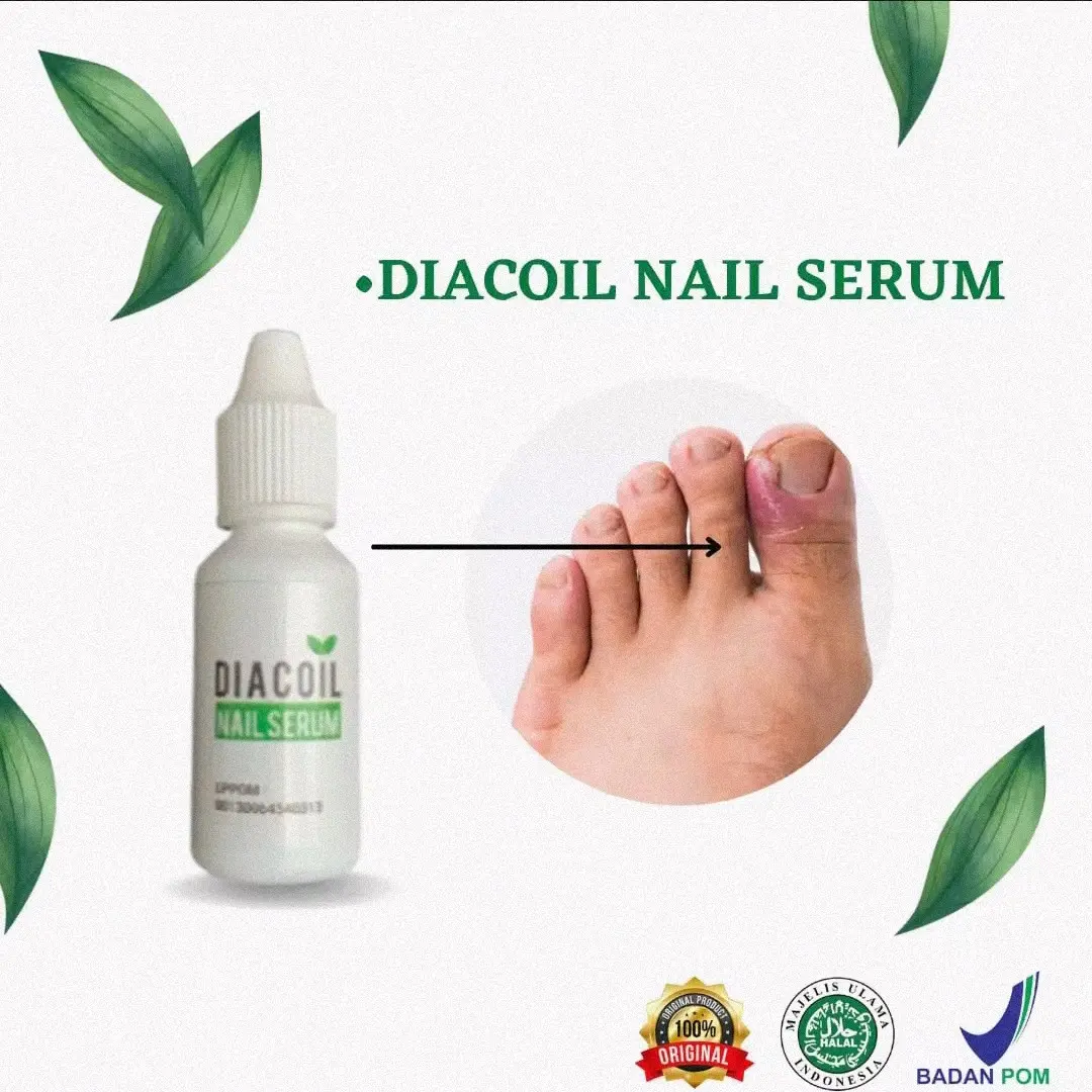 Diac oil nail penghilang kuku berjamur cantengan ampuh