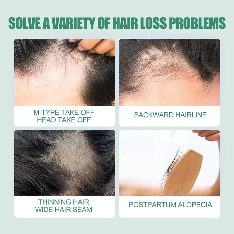 Thickening Hair Serum, Hair Root Care Oil, Scalp Care Oil, Natural Serum, Professional Hair Care Product for Men & Women 6