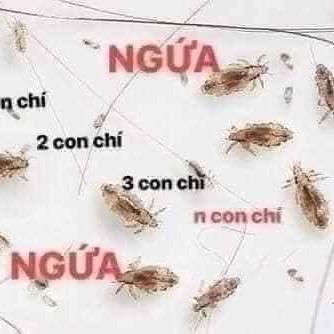 RƯỢU Ủ Chấy,Chí. Dầu Gội Diệt Chấy Chí. Ủ Chấy Cho Bé. Sạch Chấy Chí Với 1 Lần Sử Dụngl 4