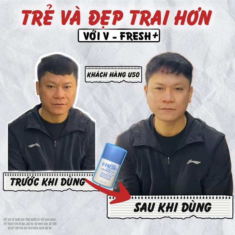 2 Hộp BBcream V-FRESH PLUS dành cho nam, nâng tone tự nhiên, kiềm dầu, chống nắng, kháng nước, che khuyết điểm 2