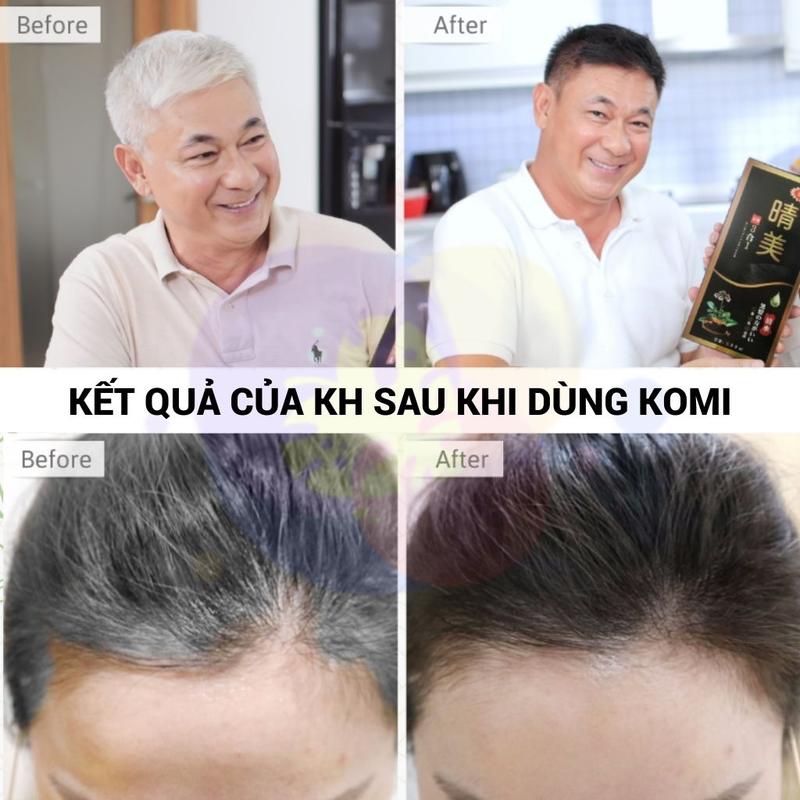Komi Shampoo, Genuine Japanese Komi Silver Shampoo, Washes Black to Help Cover Brown or Black Gray Hair Quickly, Box of 10 Packs 7