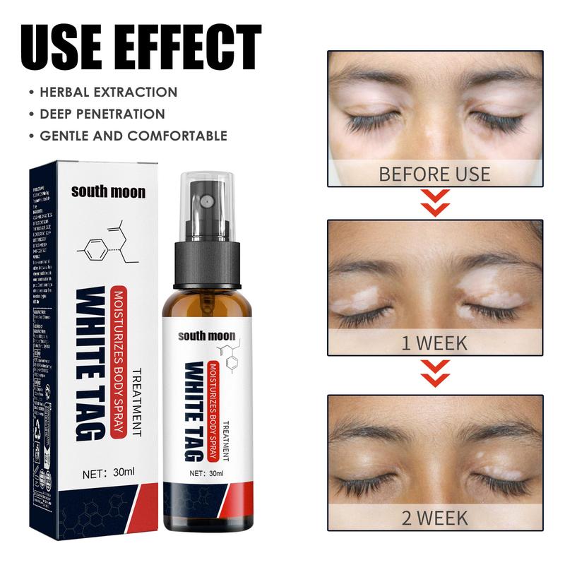 Product Introduction of South Moon Skin Repair Spray Moisturizing And Gentle Treatment Spray For Body Skin 9