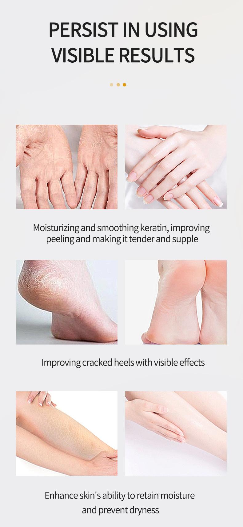 Product Introduction of Hand Cream Foot Cream Exfoliating Brightening Repair Cosmetics 8
