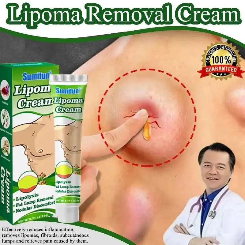 lipoma cream salep benjolan 100% Original Herbal Ampuh lipoma cream salep benjolan 7 days lipoma removal cream Tanpa Oprasi Obat Salep Benjolan Lipoma Ampuh 100% asli Obat Benjolan Ampuh Benjolan Payudara Benjolan Tangan Benjolan Leher