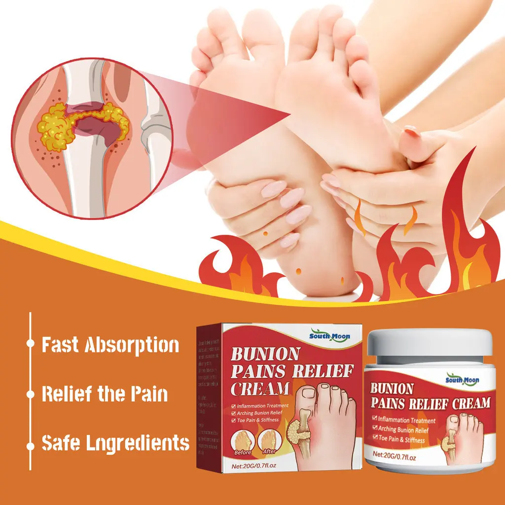 Sumifun obat asam urat - Salep Rematik Bunion Pain Relief Cream Splint Jari Kaki Hallux Valgus Pengobatan Arthritis Pereda Nyeri Pada Sendi Lutut 20g