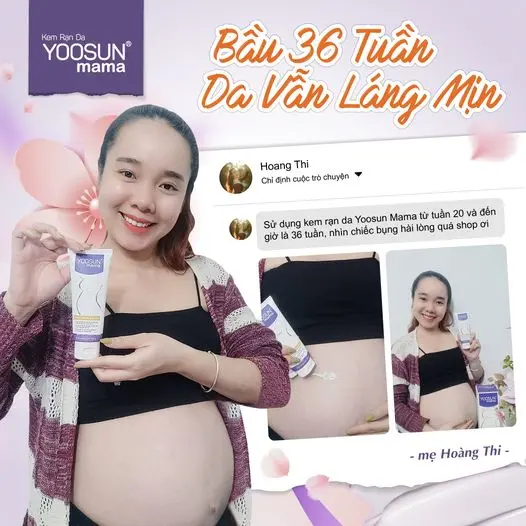 Kem bôi da Yoosun Mama hỗ trợ làm mờ vết rạn - Tuýp 100g 2