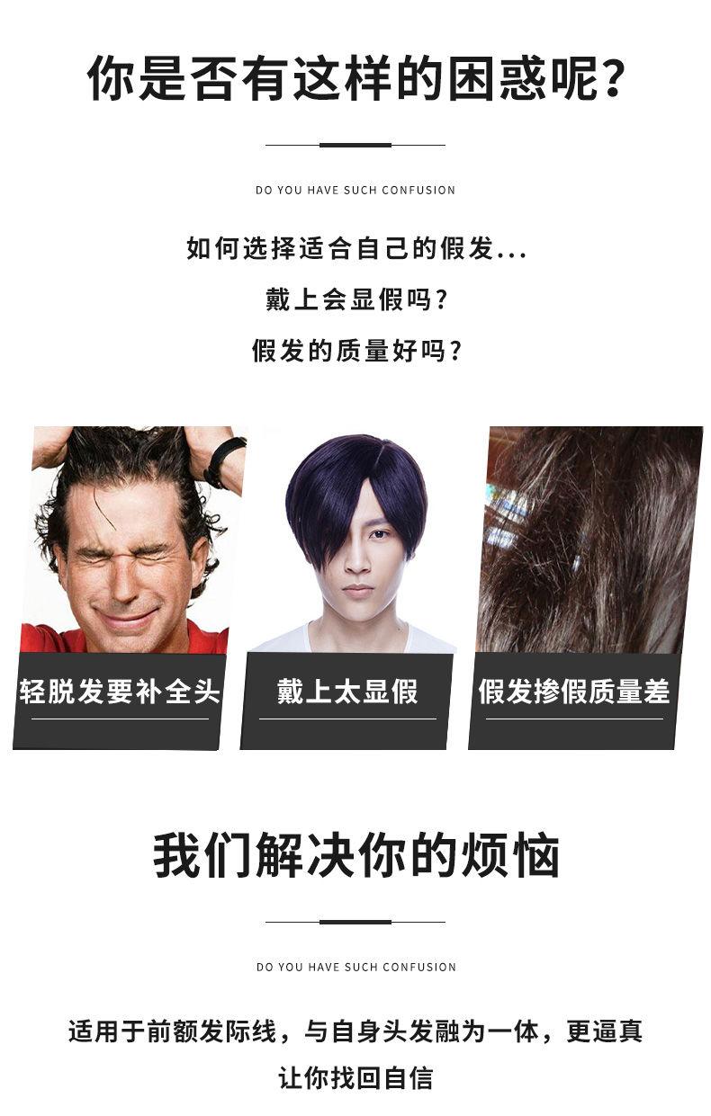 Product Introduction of Hairline fake hair stickers forehead men's high forehead men's baldness wig piece real hair seamless invisible bangs stickers men. 1