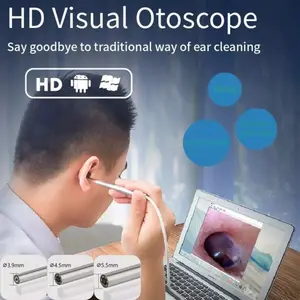 Kamera Pembersih telinga otoscope korek kuping USB micro USBwax Removal Perawatan Ear Cleaning Hitam