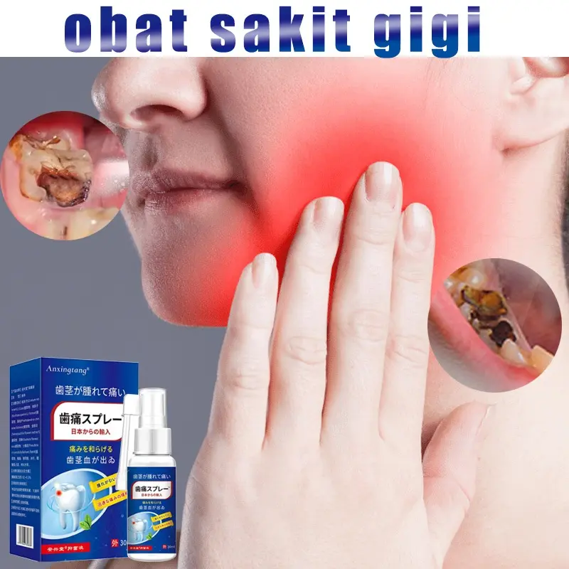 Obat sakit gigi Obat sakit gigi berlubang Obat sakit gigi semprot 20ml Semprotan Pereda Nyeri Sakit Gigi Pereda Sakit Gigi Pereda Nyeri Cepat Perawatan Mulut Pereda Cacing Gigi Gigi Berlubang Sakit Gusi Alergi
