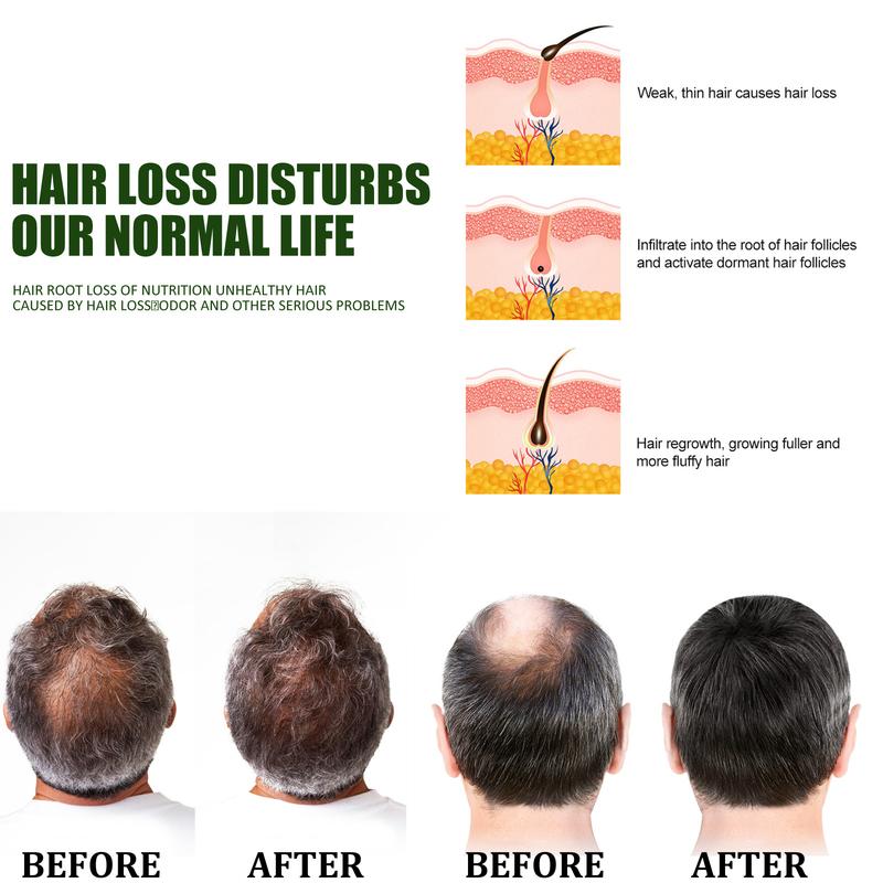 Product Introduction of Hair Growth Spray 50ML Fast Powerful Hair Grower Hair Care  Natural Hair Loss Hair Grower for Men and Women hair grower for men original ​ purc hair growth serum hair growth oil ha Promotes Hair Growth tf007 3