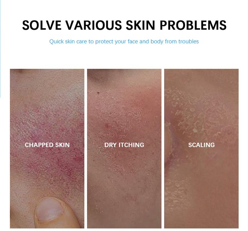 Product Introduction of Kem Khô, Hydrate và Dưỡng Ẩm, với chất lỏng B5 b5  phục  hồi  da kem  dưỡng  ẩm  cho  da  siêu  khô 1