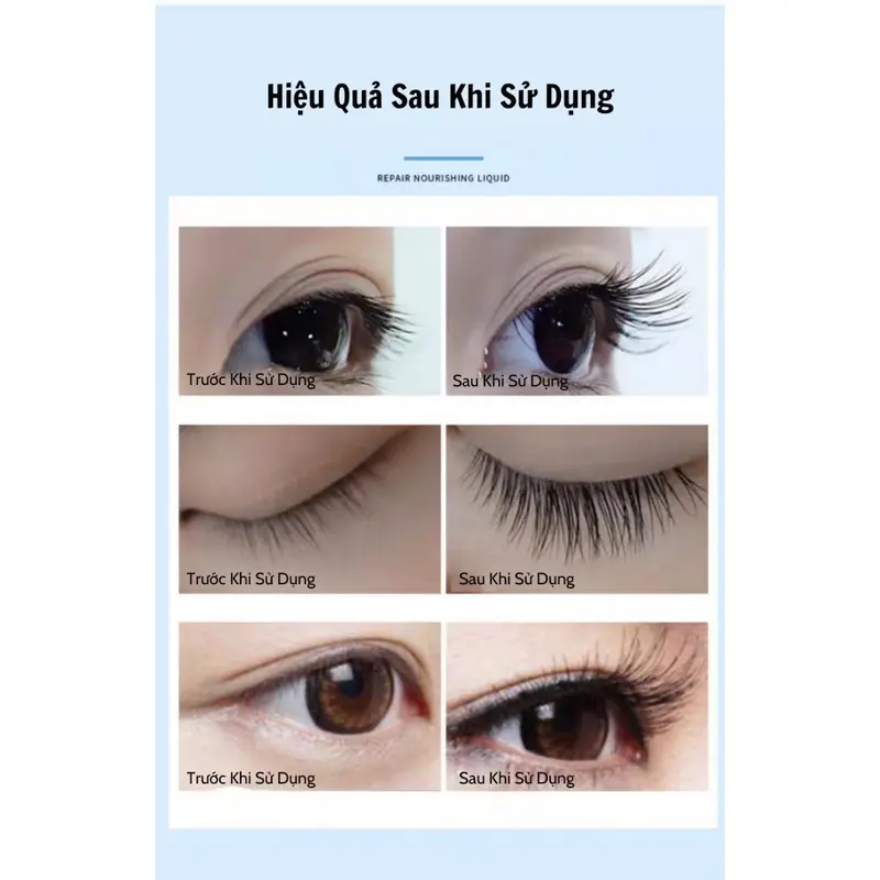 Serum Làm Dài Lông Mi, Esunya, Giúp Nuôi Dưỡng Sâu, Giúp Lông Mi Dài Và Mỏng Nữ Trang Điểm Mascara Women Cosmetic Mỹ Phẩm 6