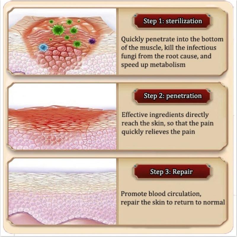 Krim Perbaikan Benjolan Lemak, Benjolan Keras, Benjolan Subkutan, Lipoma, Salep Benjolan, Krim Penghapus Lipoma, Secara Khusus Menghilangkan Beberapa Benjolan Subkutan Tunggal, Krim Benjolan Kulit / Obat Benjolan Efektif