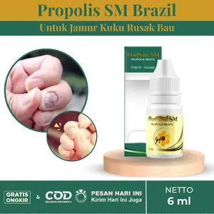 Propolis SM Untuk Mengatasi Jamur Kuku Rusak Bau Psoriasis Isi 6 ml Nail