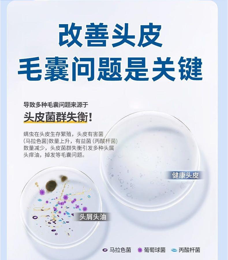 Product Introduction of Xikangwang Anti-Dandruf and Relieve Itching Washing Water Oil Removing Refreshing Skin Washing Cream Anti-Mite Grease-Overflow Moss Lotion 8